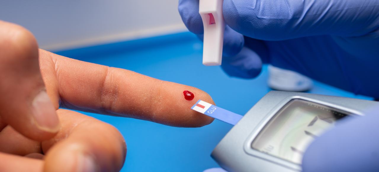 A finger-stick glucose test with a strip and meter.